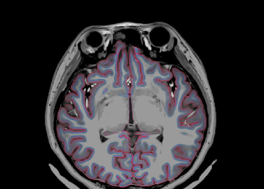 Axial (WM + Depths + Pial)