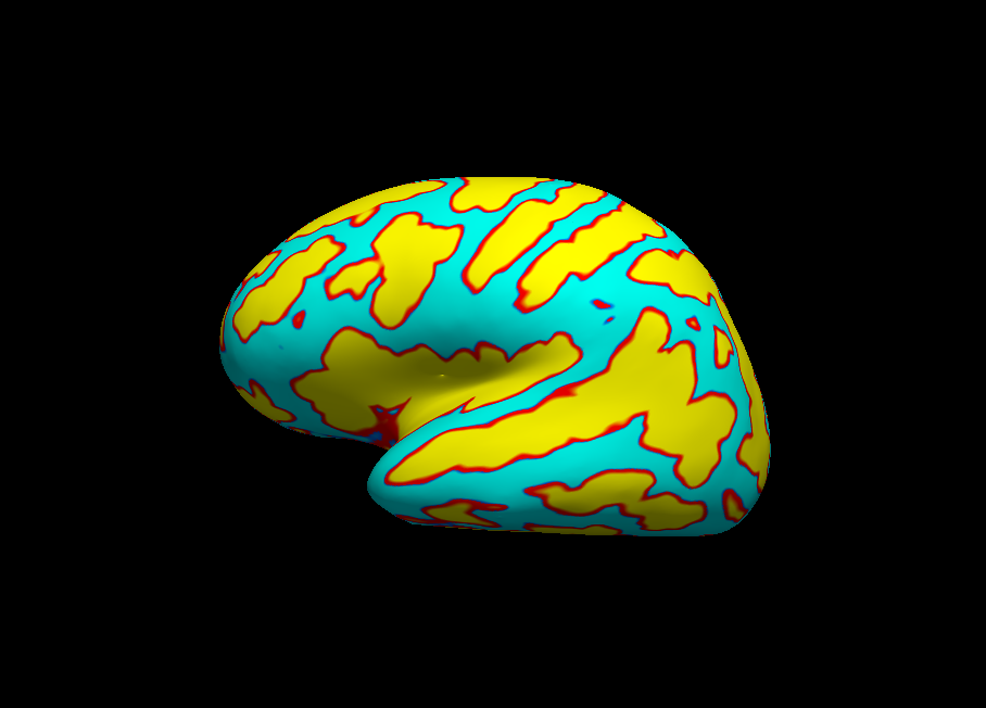 Inflated LH (Lateral)