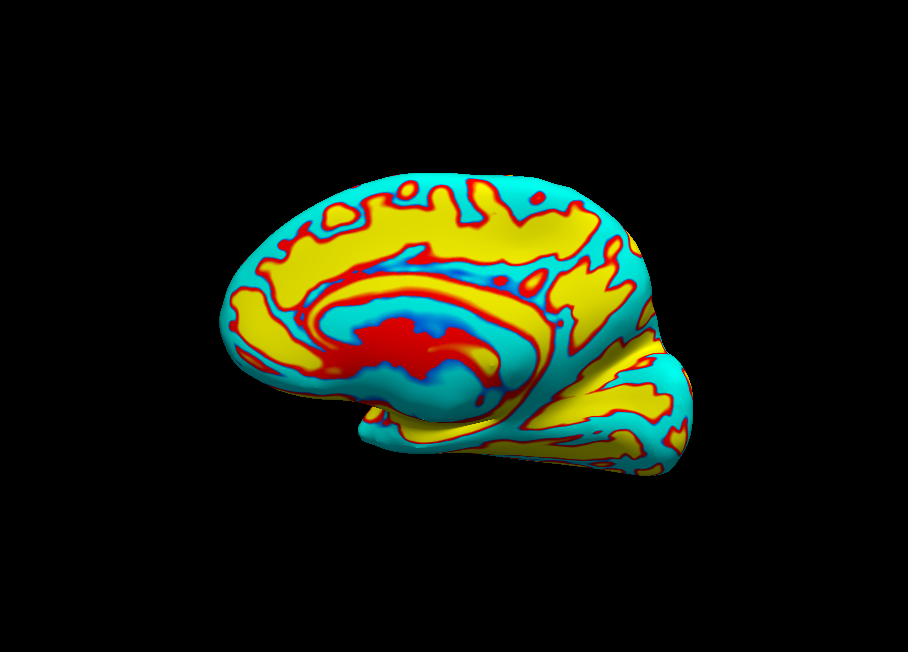 Inflated RH (Lateral)