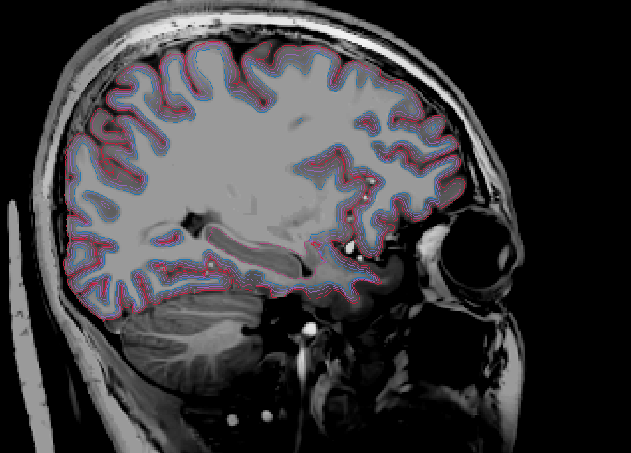 Sagittal LH (WM + Depths + Pial)