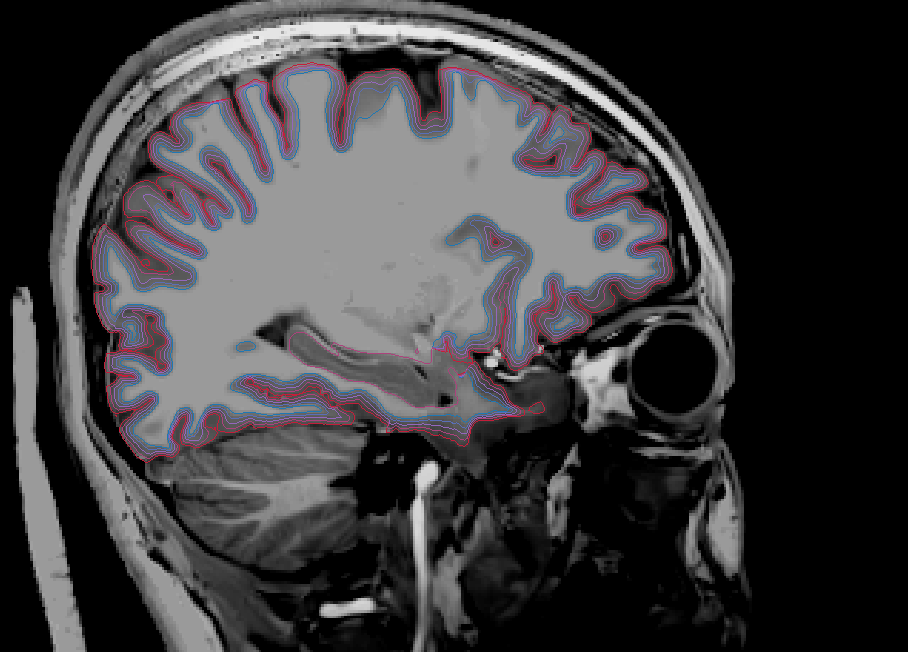 Sagittal RH (WM + Depths + Pial)